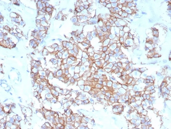 Recombinant HER-2 Antibody / ErbB2