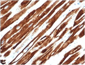Recombinant Desmin Antibody