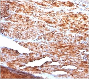 Recombinant Desmin Antibody
