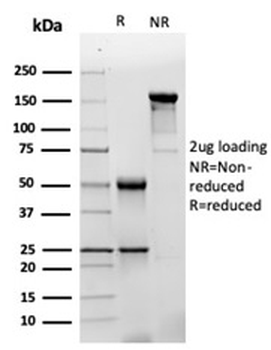 Glial Fibrillary Acidic Protein Antibody / GFAP