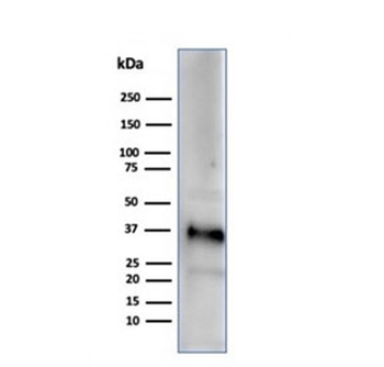 Apolipoprotein J Antibody / APO-J / Clusterin