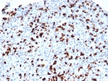 Recombinant TIA-1 Antibody / T-Cell Intracellular Antigen-1