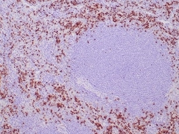 Recombinant TIA-1 Antibody / T-Cell Intracellular Antigen-1