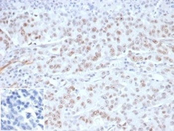 Recombinant MLH1 Antibody / MutL Homolog 1