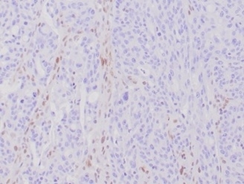 Recombinant MLH1 Antibody / MutL Homolog 1
