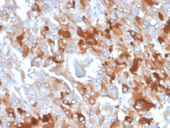 CLU Antibody / Clusterin / Apolipoprotein J / APO-J