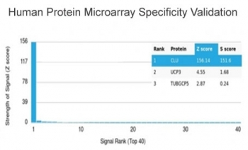 CLU Antibody / Clusterin / Apolipoprotein J / APO-J