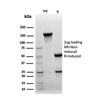 CLU Antibody / Clusterin / Apolipoprotein J / APO-J