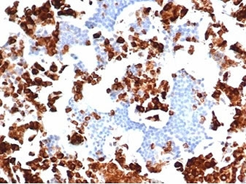 Recombinant MPO Antibody / Myeloperoxidase