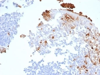 Recombinant MPO Antibody / Myeloperoxidase