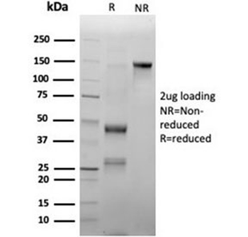 Recombinant MPO Antibody / Myeloperoxidase