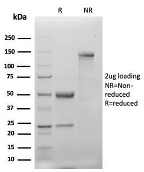 Recombinant Keratin 20 Antibody / CK20 / Cytokeratin 20