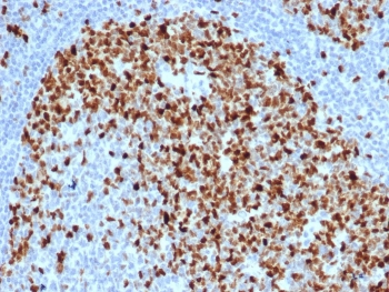 Recombinant Topoisomerase II alpha Antibody / TOP2A