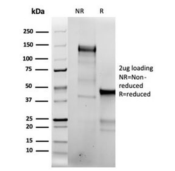 Recombinant Topoisomerase II alpha Antibody / TOP2A
