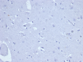Recombinant TOP2A Antibody / Topoisomerase II alpha