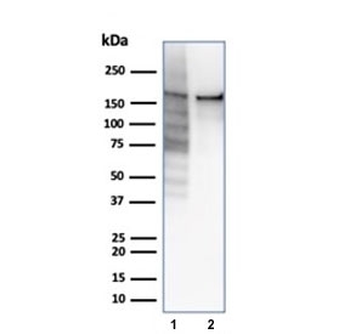 Recombinant TOP2A Antibody / Topoisomerase II alpha