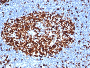 Recombinant Ki-67 Antibody
