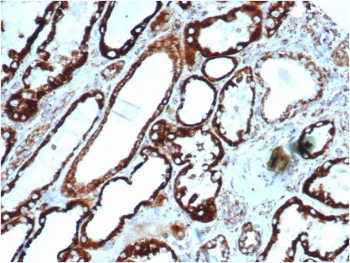 Recombinant HSP60 Antibody
