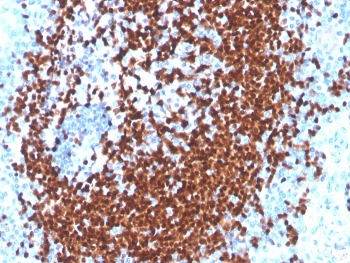 Recombinant PAX5 Antibody