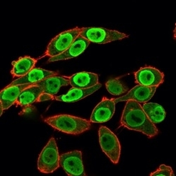 SET Antibody / Protein SET / TAFI