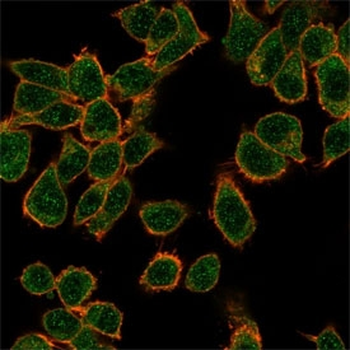GTF2H2C Antibody