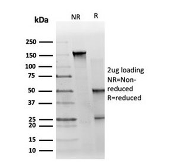 GTF2H2C Antibody