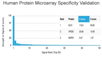 ELK1 Antibody / ETS Like-1 protein Elk-1