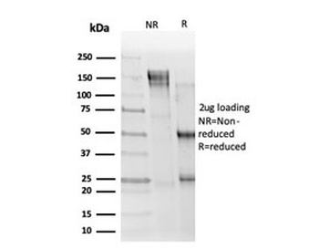 ELK1 Antibody / ETS Like-1 protein Elk-1
