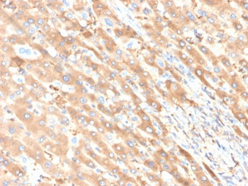 ALB Antibody / Albumin