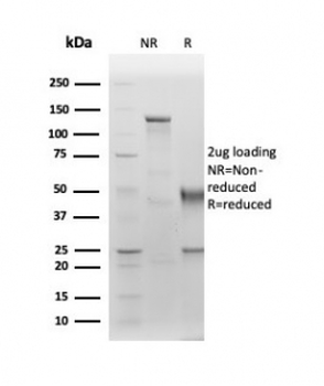 ALB Antibody / Albumin