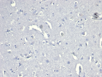 Recombinant CD38 Antibody