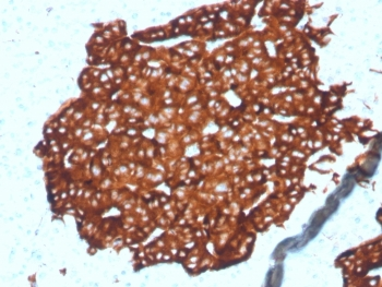Recombinant Synaptophysin Antibody / SYP