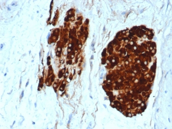 Recombinant INHA Antibody / Inhibin alpha