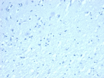 Recombinant INHA Antibody / Inhibin alpha