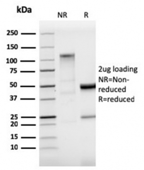 Recombinant StAR Antibody / Steroidogenic acute regulatory protein