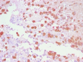 Tyrosinase-Related Protein-1 Antibody / TRP1 / TYRP1