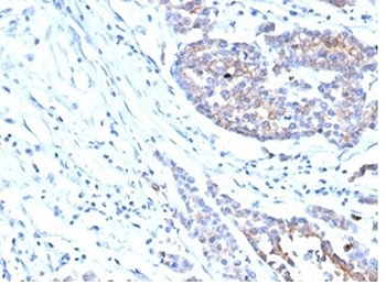 IGF1R Antibody / Insulin like growth factor 1 receptor