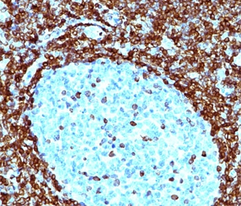 Bcl-2 Antibody