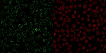 CD79a Antibody