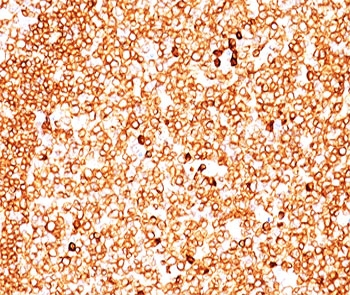 CD79a Antibody Cocktail