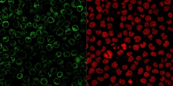 CD79a Antibody Cocktail