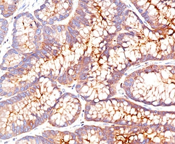 CEA Antibody / CEACAM5