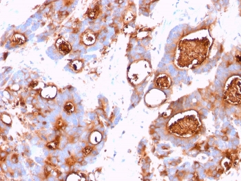 CEA Antibody / CEACAM5