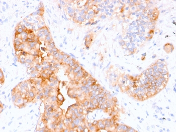 CEA Antibody / CEACAM5