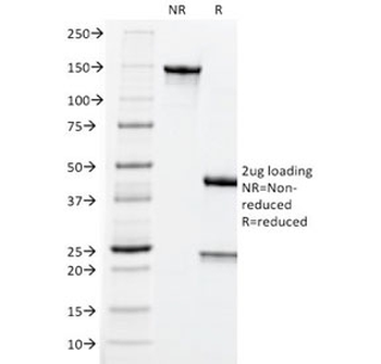 CEA Antibody / CEACAM5