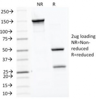 HSP60 Antibody / HSPD1