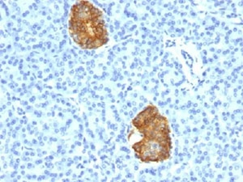 Insulin Antibody Cocktail
