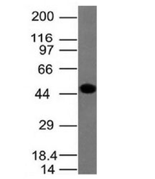 Cytokeratin 8 Antibody