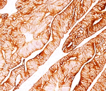 Cytokeratin 8 Antibody