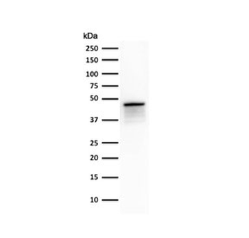 Cytokeratin 8 Antibody